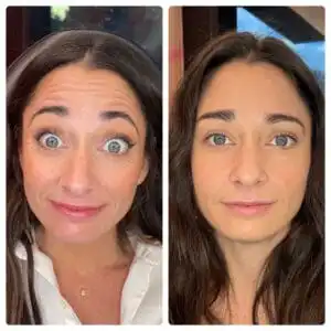 Brunette woman with one photo of wrinkles on her whole face, and one photo without wrinkles, displaying her botox before and after images in South Jordan, UT.