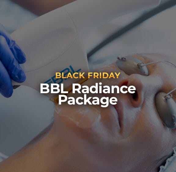 BBL Radiance Package: <br><span class="prod_sub">3 BBL Face Treatments</span>
