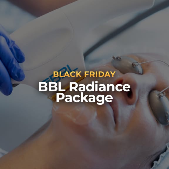 BBL Radiance Package: <br><span class="prod_sub">3 BBL Face Treatments</span>