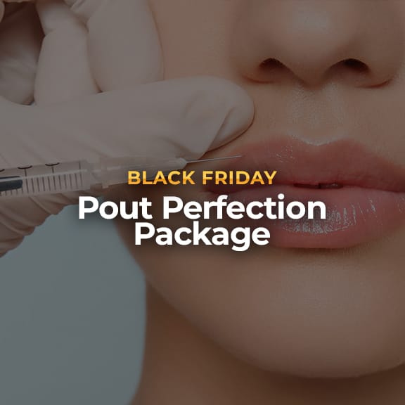 Pout Perfection Package: <br><span class="prod_sub">1 Syringe Lip Filler + Free Lip Flip</span>