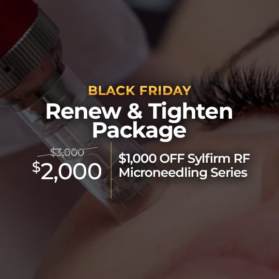 black-friday-rf-microneedling-deal-utah