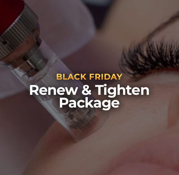 Renew & Tighten Package:<br><span class="prod_sub"> $1,000 OFF Sylfirm RF Microneedling Series</span>